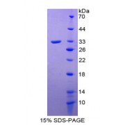 SDS-PAGE analysis of Plasminogen Protein.