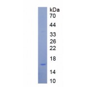 SDS-PAGE analysis of recombinant Rat Neuromedin U Protein.