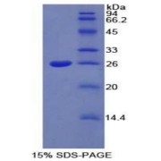 SDS-PAGE analysis of Ceruloplasmin Protein.