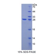 SDS-PAGE analysis of Galectin 12 Protein.