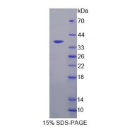 SDS-PAGE analysis of Galectin 4 Protein.