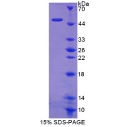 SDS-PAGE analysis of Hexokinase 1 Protein.