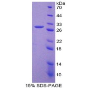 SDS-PAGE analysis of Thrombopoietin Protein.