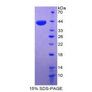 SDS-PAGE analysis of recombinant Rat Orexin A Protein.