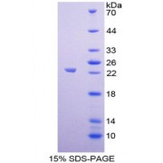 SDS-PAGE analysis of Galectin 8 Protein.