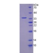 SDS-PAGE analysis of Transketolase Protein.