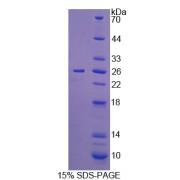 SDS-PAGE analysis of IL12A Protein.