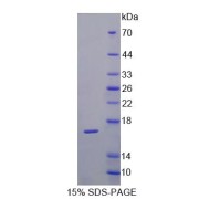 SDS-PAGE analysis of VasoactiveIntestinalPeptideReceptor1 Protein.