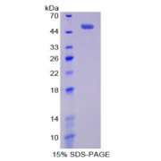 SDS-PAGE analysis of BAFFR Protein.