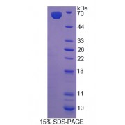 SDS-PAGE analysis of recombinant Rat Monoamine Oxidase A Protein.