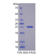 SDS-PAGE analysis of TRPM7 Protein.