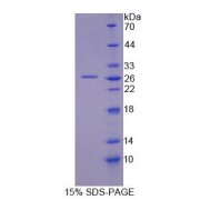 SDS-PAGE analysis of Carnitine Palmitoyltransferase 2, Mitochondrial Protein.