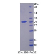 SDS-PAGE analysis of Phosphofructokinase, Platelet Protein.