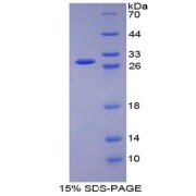 SDS-PAGE analysis of Glutathione Reductase Protein.