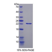 SDS-PAGE analysis of CDKN1A Protein.