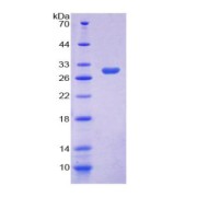 SDS-PAGE analysis of Rat MX1 Protein.