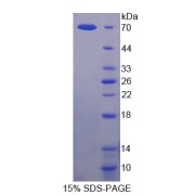 SDS-PAGE analysis of recombinant Human Semaphorin 4D Protein.