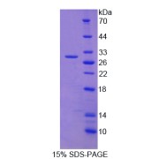 SDS-PAGE analysis of ADAM17 Protein.