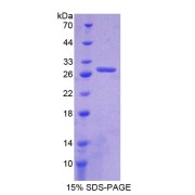 SDS-PAGE analysis of Angiopoietin 4 Protein.