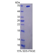 SDS-PAGE analysis of IL23R Protein.