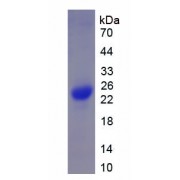 SDS-PAGE analysis of recombinant Rat Chymase 1, Mast Cell (CMA1) Protein.