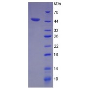 SDS-PAGE analysis of Aquaporin 4 Protein.