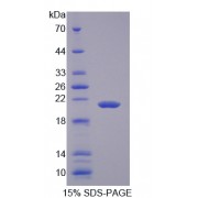 SDS-PAGE analysis of Insulin Like Growth Factor 2 (IGF2) Protein.