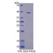 SDS-PAGE analysis of recombinant Rat IL11RA Protein.
