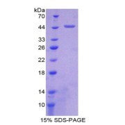 SDS-PAGE analysis of Cluster Of Differentiation 97 Protein.