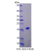 SDS-PAGE analysis of IL25 Protein.