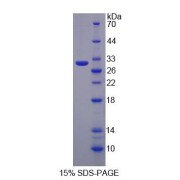 SDS-PAGE analysis of Glycoprotein A33 Protein.