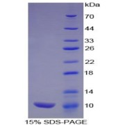 SDS-PAGE analysis of beta Thromboglobulin Protein.