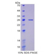 SDS-PAGE analysis of Glucose 6 Phosphate Isomerase Protein.