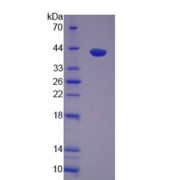 SDS-PAGE analysis of recombinant Rat Prothrombin Fragment 1+2 Protein.