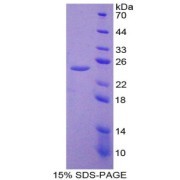 SDS-PAGE analysis of IL27RA Protein.