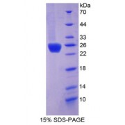 SDS-PAGE analysis of Growth Hormone Protein.