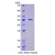 SDS-PAGE analysis of recombinant Rat Histidine Rich Glycoprotein.