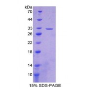 SDS-PAGE analysis of CYP27B1 Protein.