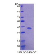 SDS-PAGE analysis of CDKN2A Protein.