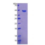 SDS-PAGE analysis of Lymphotactin Protein.