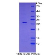 SDS-PAGE analysis of recombinant Rat Fibrillin 1 Protein.