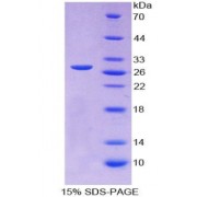 SDS-PAGE analysis of Myogenin Protein.