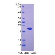 SDS-PAGE analysis of Superoxide Dismutase 1, Soluble Protein.