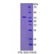 SDS-PAGE analysis of IL1B Protein.