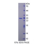 SDS-PAGE analysis of Visinin Like Protein 1 Protein.