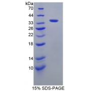 SDS-PAGE analysis of A Kinase Anchor Protein 11 Protein.