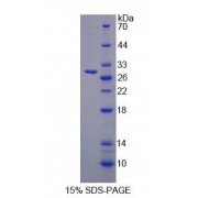 SDS-PAGE analysis of Follistatin Like Protein 3 Protein.