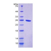 SDS-PAGE analysis of Signal Regulatory Protein alpha Protein.