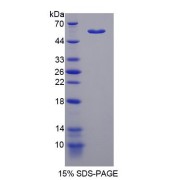 SDS-PAGE analysis of Transketolase Like Protein 1 Protein.