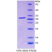 SDS-PAGE analysis of Sp140 Nuclear Body Protein.